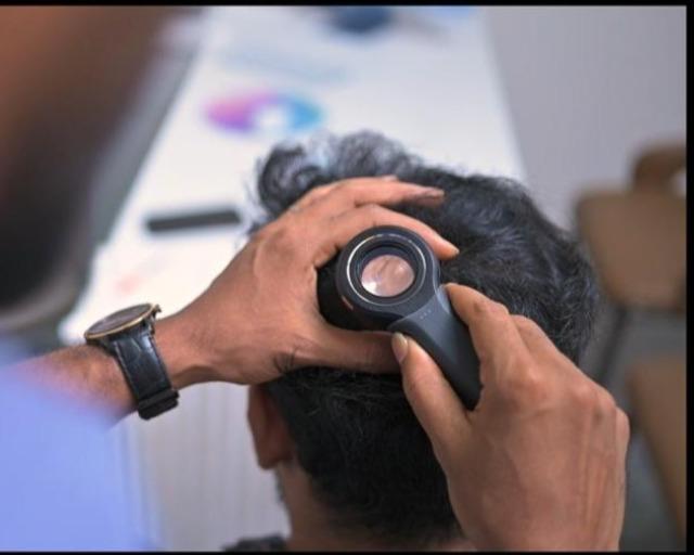 prp hair loss treatment salem