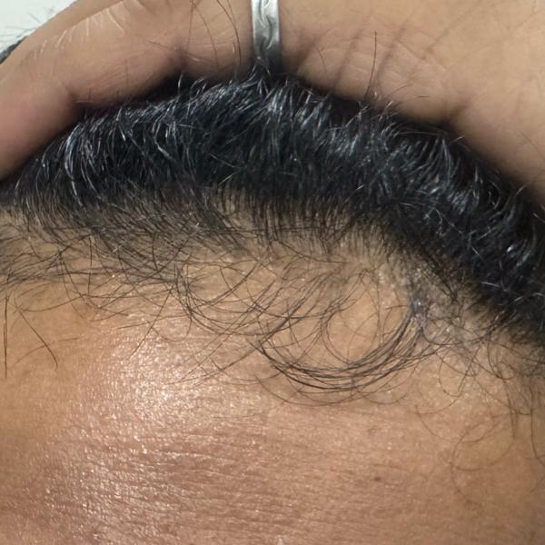 dandruff treatment specialist 