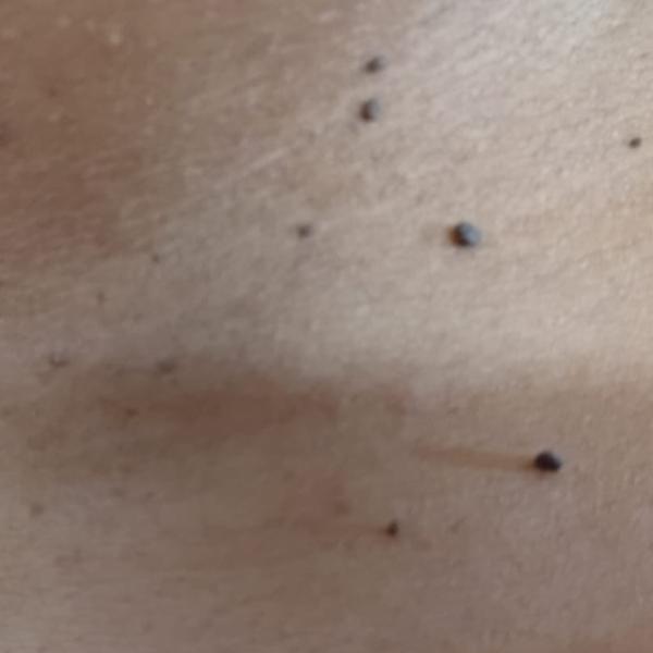 nearest dermatologist in trich