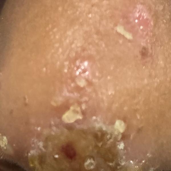skin infection doctor near tri