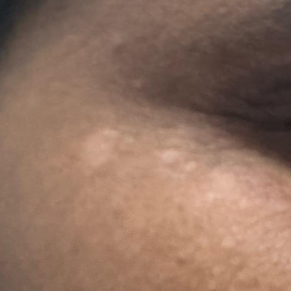 Dr. Valarmathi, a nearby skin