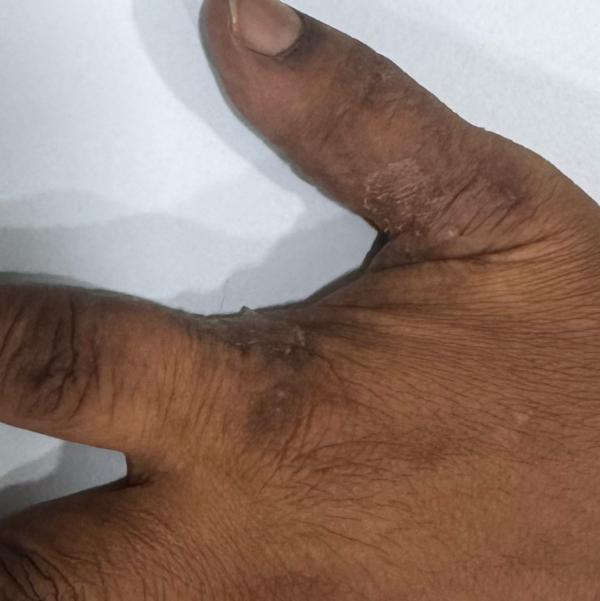 Dr.Valarmathi, a skin doctor i