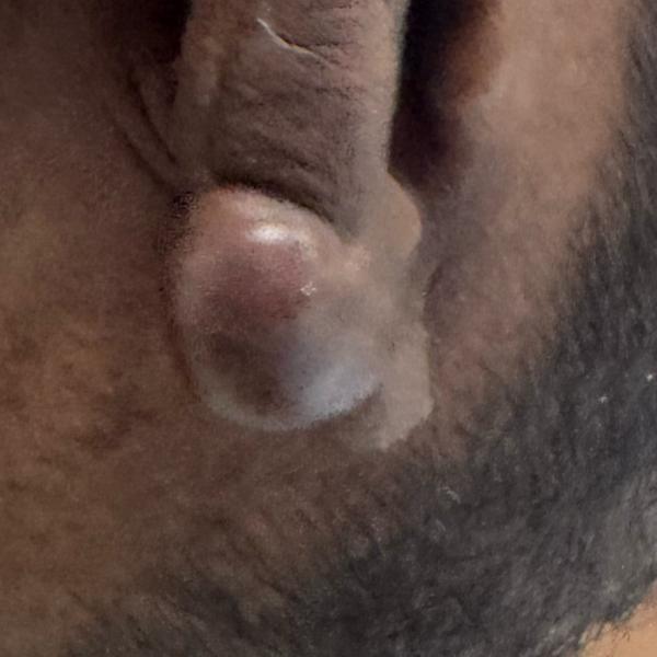 Dr.Valarmathi, a dermatologist