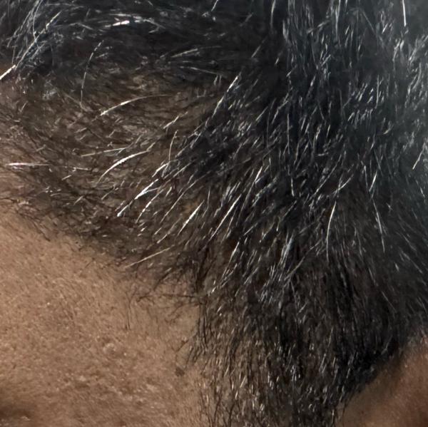 Dr. Valarmathi, the best derma