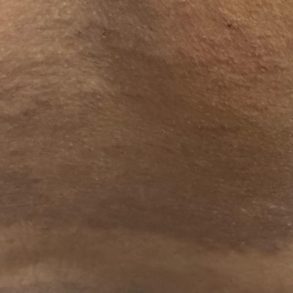 Dr. Valarmathi, a nearby funga