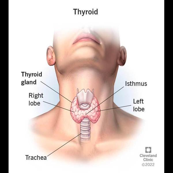 Radioactive Iodine Treatment i