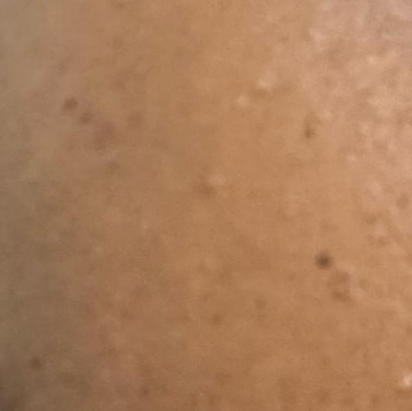 Dr.Valarmathi, a nearby skin p