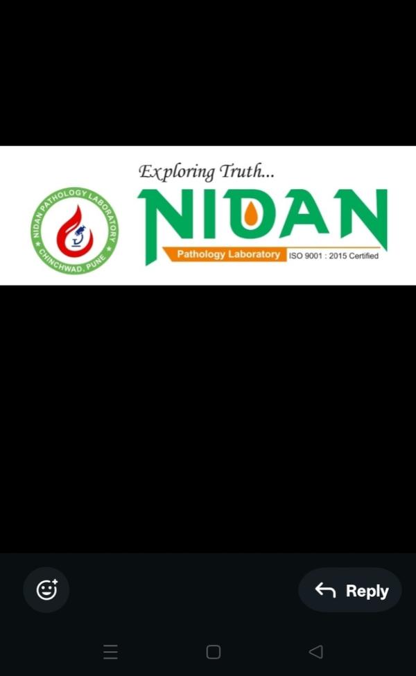 nicotine detection in urine