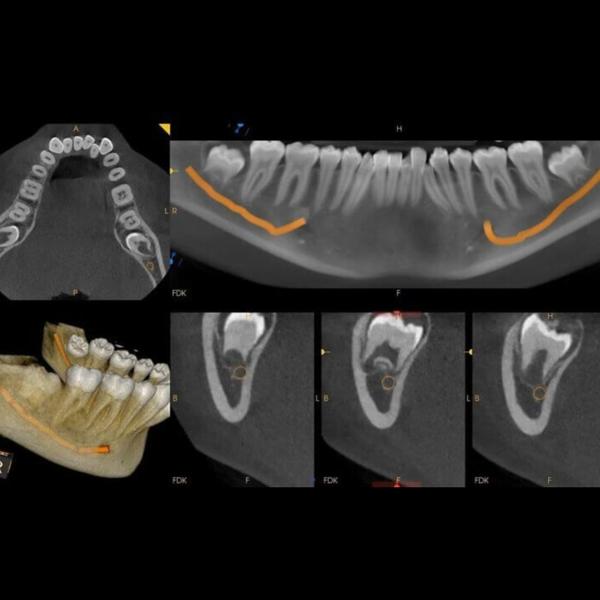 dental and jaw disorder diagno