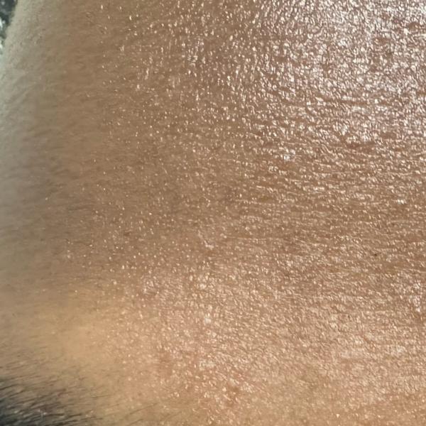 hydra facial expert trichy