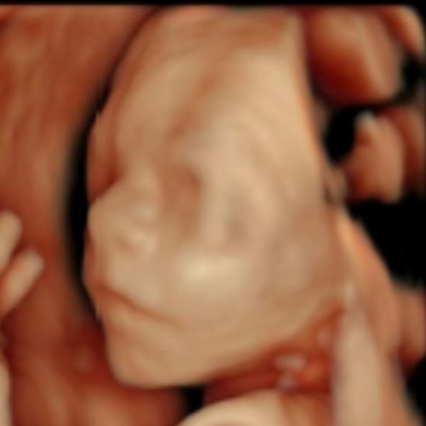 high resolution ultrasound roh