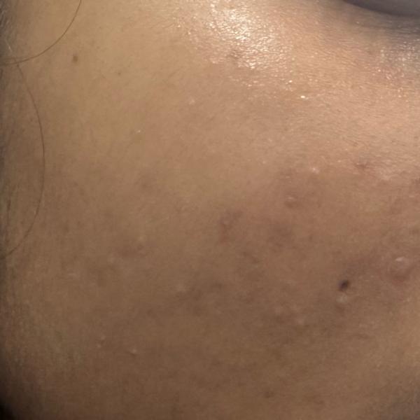 dermatologist doctor in trichy