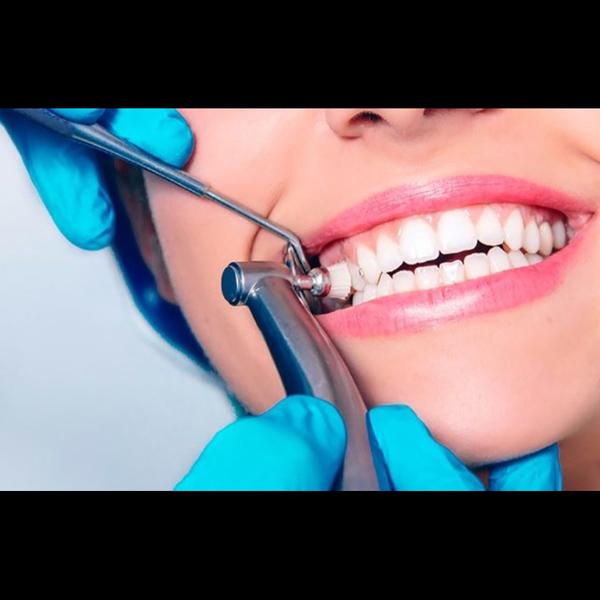 Best Professional Teeth Cleani