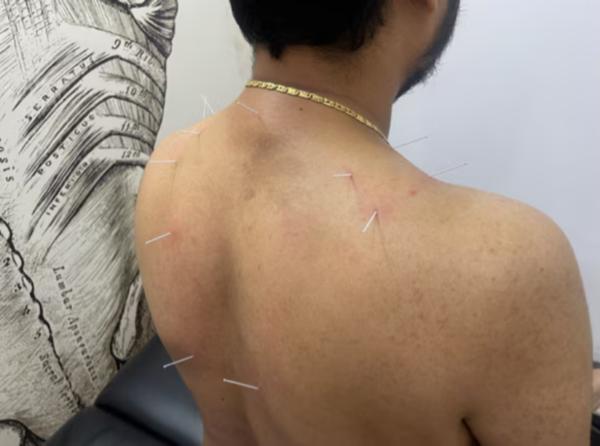 soft tissue work for cervical 