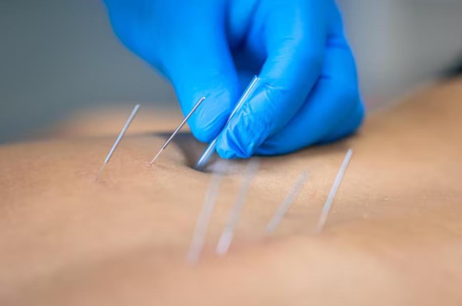 releasing muscle tension techn