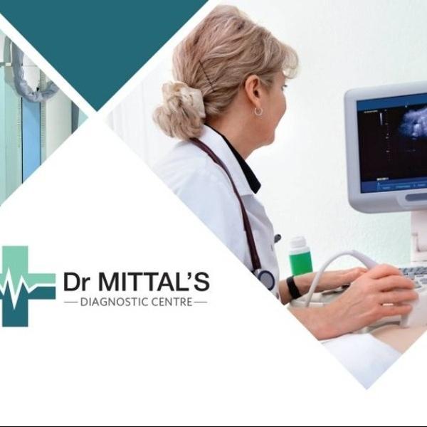 ecg test rohini delhi