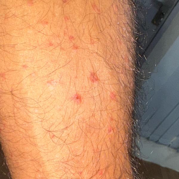 nearest skin infection doctor 
