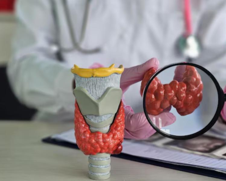 Thyroid disorders are quite co