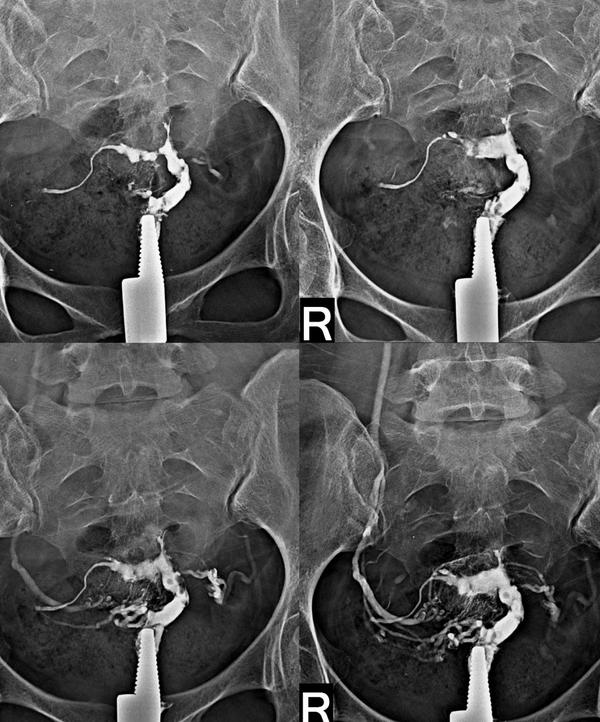 ultrasound for ovulation cycle