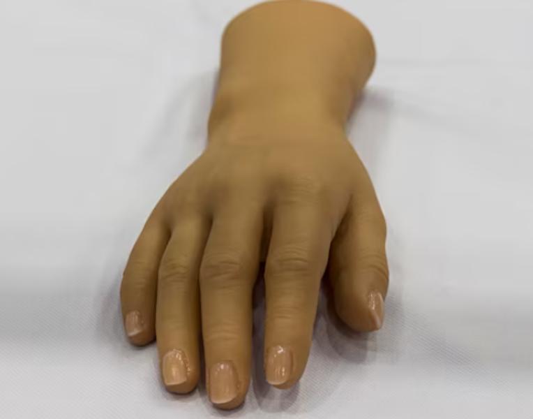 If you've experienced the loss of a limb, a silico