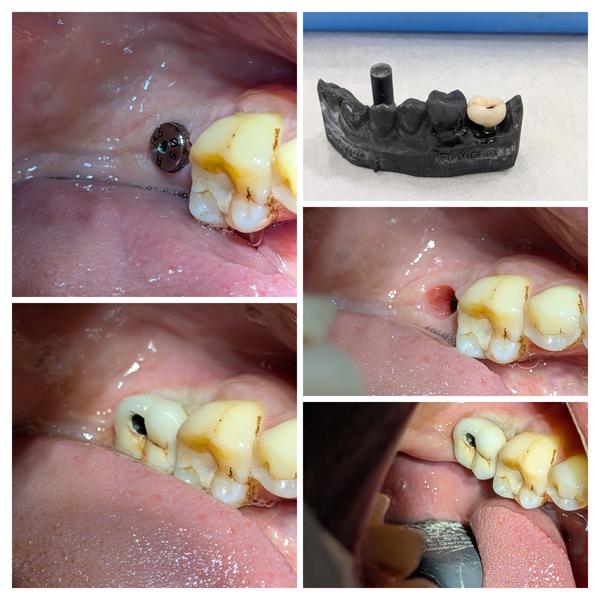 update image