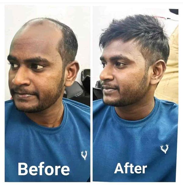 Customize Hair Wigs & patch in