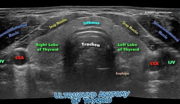 thyroid ultrasound in rohini d