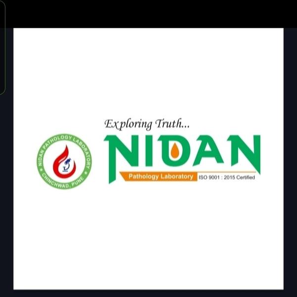 urine sodium test for kidney f