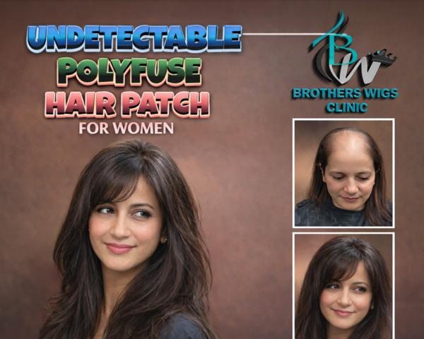 hair patch for crown area