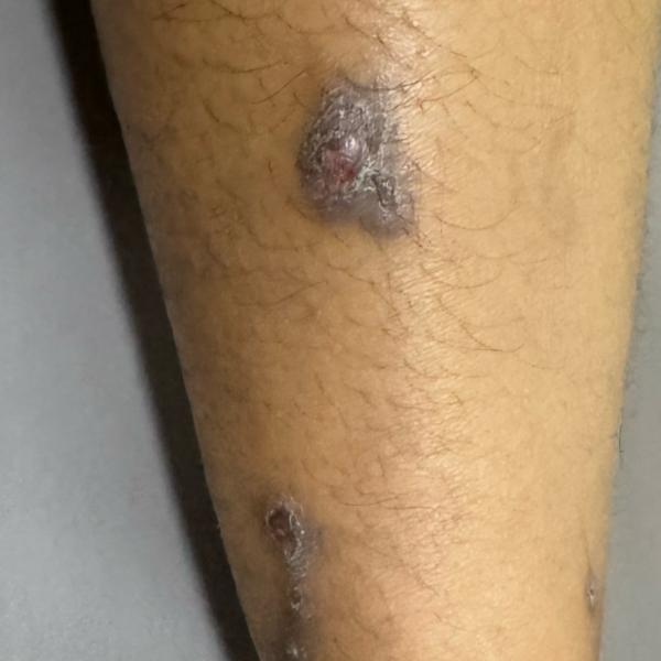 trusted dermatologist dr valar