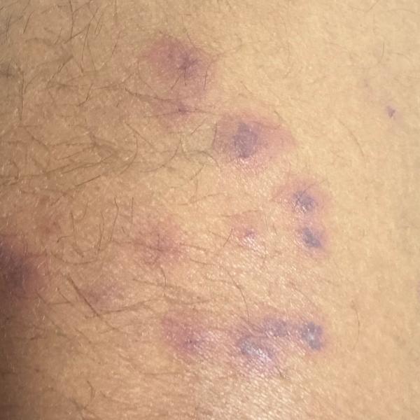skin disease diagnosis and tre