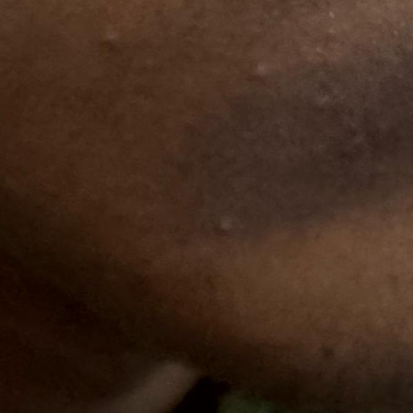 trusted skin doctor in trichy