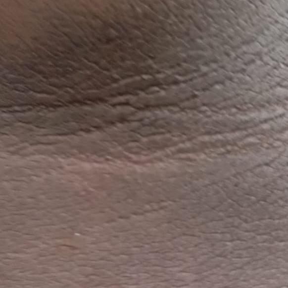 expert skin peel doctor trichy