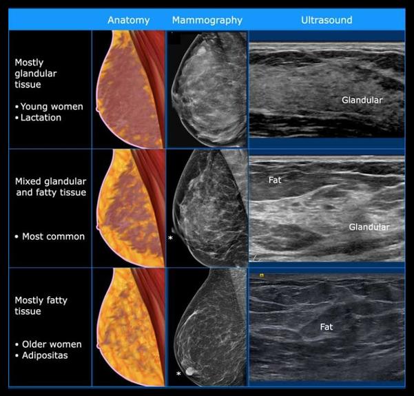 ultrasound based blood flow vi