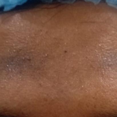 expert dermatologist near me