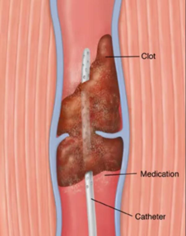 Sudden medical emergencies lea
