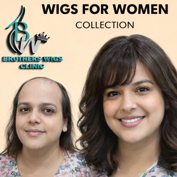 natural hairline and color ble