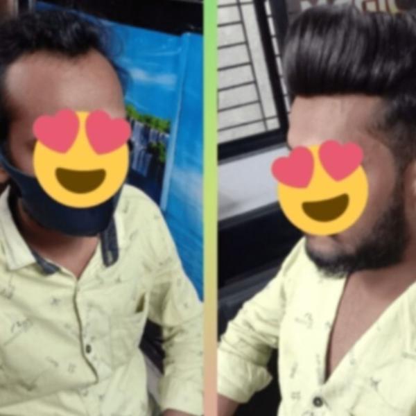 Hair thinning in men often starts quietl