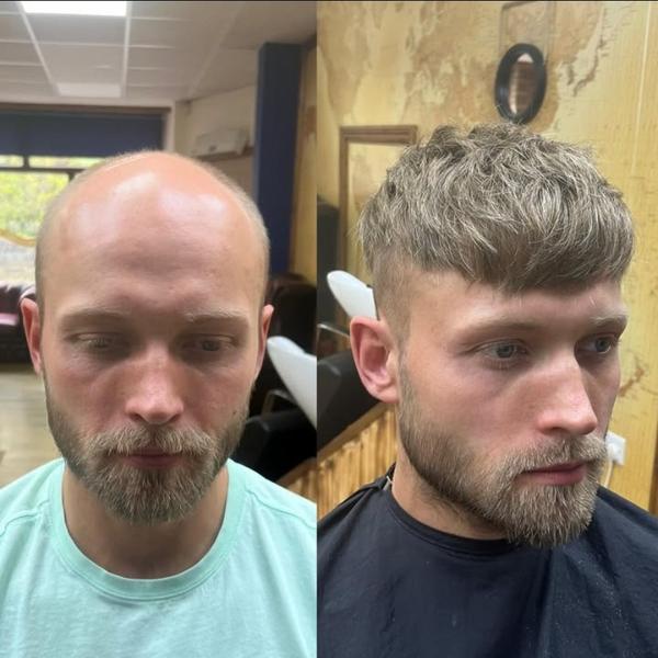 Hair Patch Service in Rohini H