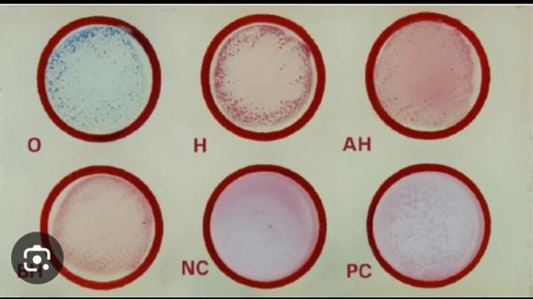 false positive typhoid test re