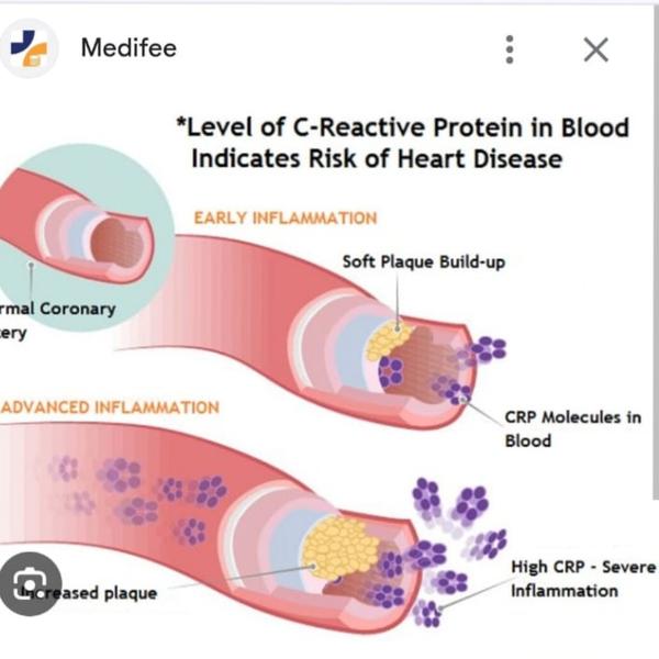 infections autoimmune diseases