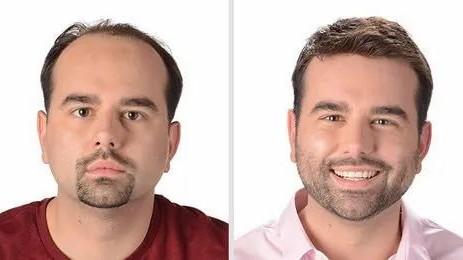 hair_studio_clinic Hair Patch 