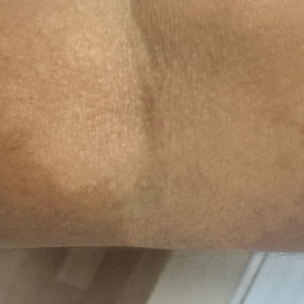 best dermatologist for dandruf