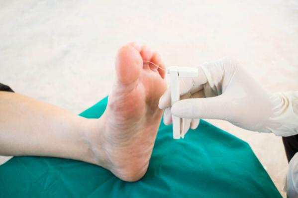 Small foot concerns can quietl