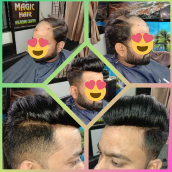 Hair patches have evolved from basic cov