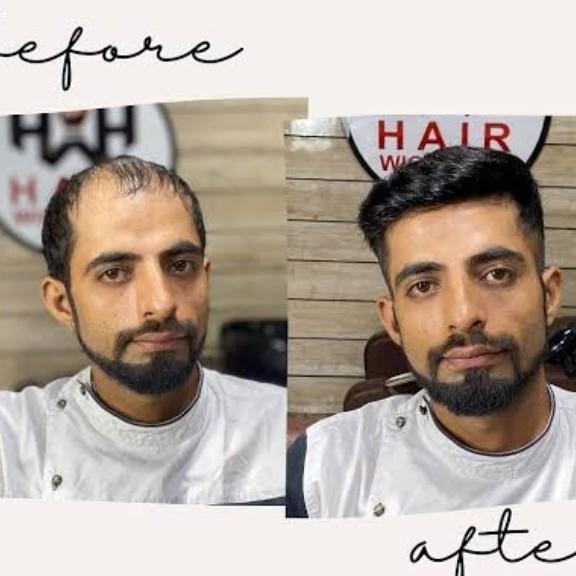 waterproof adhesive hair patch