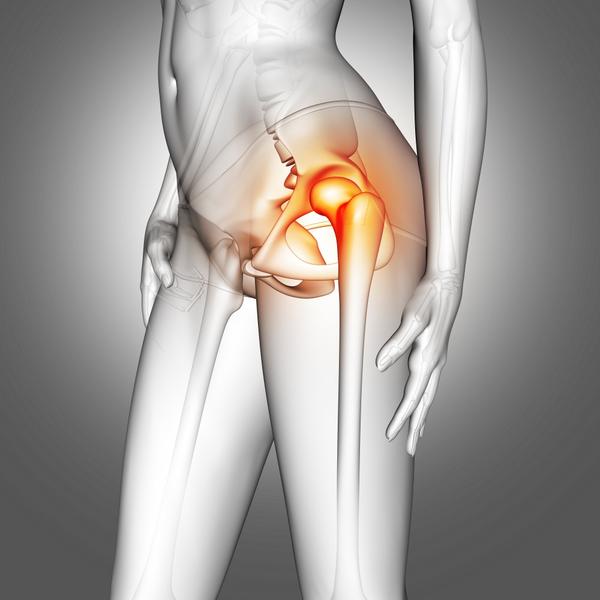 Hip pain o