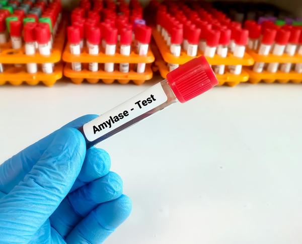 elevated amylase level causes
