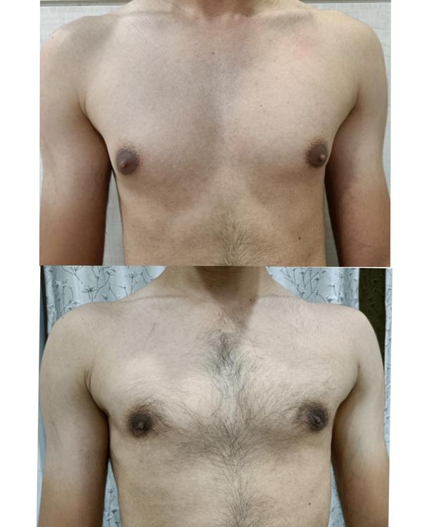 update image