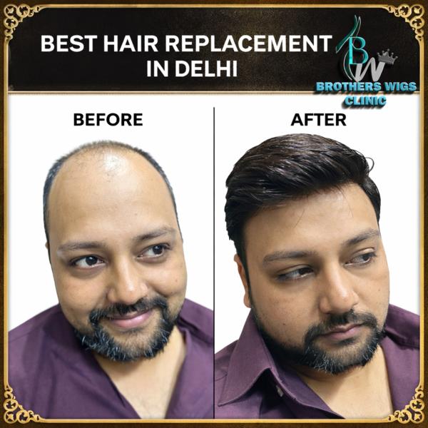 hair bonding and weaving servi